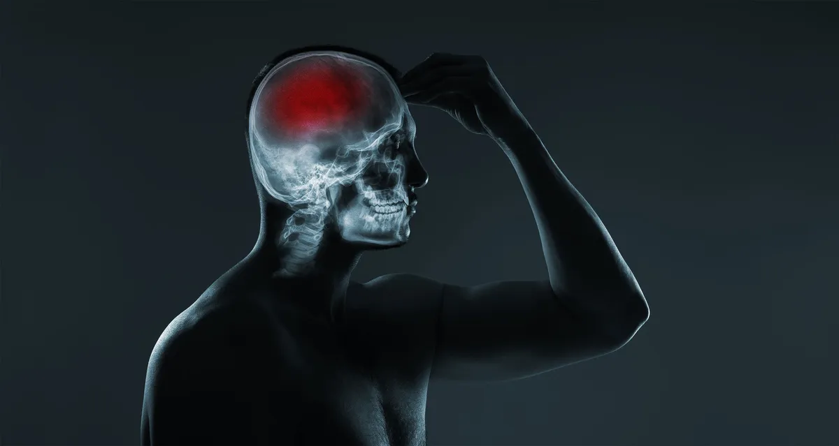 How Artificial Intelligence is Revolutionising Stroke Care